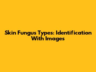 Skin Fungus Types: Identification With Images